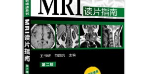 影像读片从入门到精通系列–MRI读片指南(第二版)(医学影像类畅销书升级再版，病种更齐全，病例更典型，图片更清晰，解释更详尽)[pdf txt epub azw3 mobi]